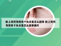 脸上突然发现有个白点是怎么回事 脸上突然发现有个白点是怎么回事图片