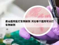 唐山医院能打生物制剂 河北哪个医院可以打生物制剂