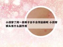 小孩穿了同一条裤子会不会传染癣呢 小孩穿裤头有什么副作用