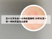 五十几岁头皮一小块的是癣吗 50岁头发一块一块的秃是怎么回事