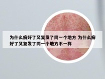 为什么癣好了又复发了同一个地方 为什么癣好了又复发了同一个地方不一样