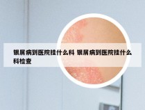 银屑病到医院挂什么科 银屑病到医院挂什么科检查