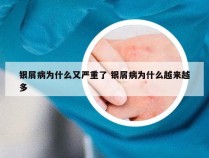 银屑病为什么又严重了 银屑病为什么越来越多