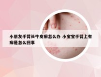 小朋友手臂长牛皮癣怎么办 小宝宝手臂上有癣是怎么回事