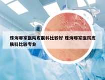 珠海哪家医院皮肤科比较好 珠海哪家医院皮肤科比较专业