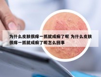 为什么皮肤很痒一抓就成癣了呢 为什么皮肤很痒一抓就成癣了呢怎么回事