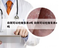 白斑可以吃维生素e吗 白斑可以吃维生素e吗