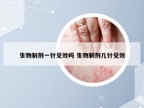 生物制剂一针见效吗 生物制剂几针见效