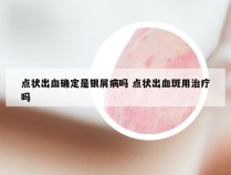 点状出血确定是银屑病吗 点状出血斑用治疗吗