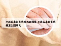 小孩头上好多头癣怎么回事 小孩头上好多头癣怎么回事儿