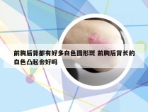 前胸后背都有好多白色圆形斑 前胸后背长的白色凸起会好吗