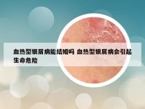 血热型银屑病能结婚吗 血热型银屑病会引起生命危险