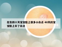 出生四十天宝宝脸上很多小白点 40天的宝宝脸上长了白点