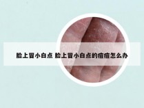 脸上冒小白点 脸上冒小白点的痘痘怎么办