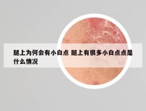 腿上为何会有小白点 腿上有很多小白点点是什么情况