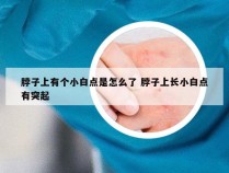 脖子上有个小白点是怎么了 脖子上长小白点有突起