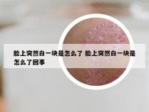 脸上突然白一块是怎么了 脸上突然白一块是怎么了回事