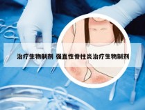 治疗生物制剂 强直性脊柱炎治疗生物制剂