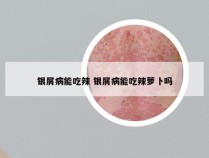 银屑病能吃辣 银屑病能吃辣萝卜吗