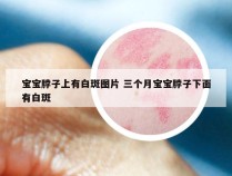 宝宝脖子上有白斑图片 三个月宝宝脖子下面有白斑