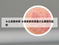 小儿皮肤白斑 小孩皮肤白斑是什么原因引起的