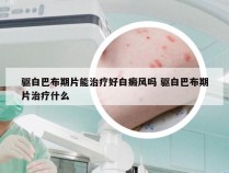 驱白巴布期片能治疗好白癜风吗 驱白巴布期片治疗什么