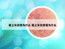 腿上长白斑为什么 腿上长白斑是为什么