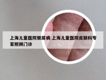 上海儿童医院银屑病 上海儿童医院皮肤科专家照顾门诊