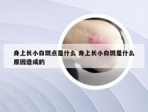 身上长小白斑点是什么 身上长小白斑是什么原因造成的