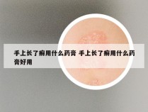 手上长了癣用什么药膏 手上长了癣用什么药膏好用