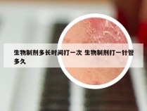 生物制剂多长时间打一次 生物制剂打一针管多久