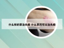 什么样的草治头癣 什么草药可以治头癣