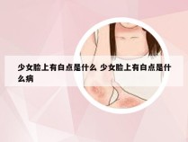 少女脸上有白点是什么 少女脸上有白点是什么病