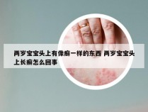 两岁宝宝头上有像癣一样的东西 两岁宝宝头上长癣怎么回事