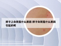 脖子上白斑是什么原因 脖子白斑是什么原因引起的呢