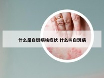 什么是白斑病啥症状 什么叫白斑病