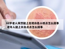 60岁老人突然腿上出现白色小斑点怎么回事 老年人腿上长白点点怎么回事