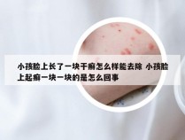 小孩脸上长了一块干癣怎么样能去除 小孩脸上起癣一块一块的是怎么回事