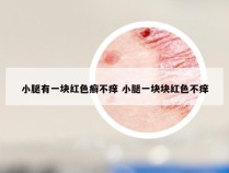 小腿有一块红色癣不痒 小腿一块块红色不痒