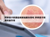 转移因子胶囊能膀胱粘膜白斑吗 转移因子胶襄的副作用