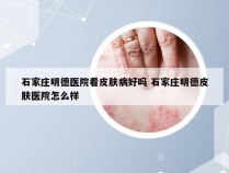 石家庄明德医院看皮肤病好吗 石家庄明德皮肤医院怎么样