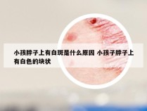 小孩脖子上有白斑是什么原因 小孩子脖子上有白色的块状