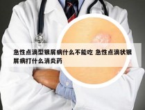 急性点滴型银屑病什么不能吃 急性点滴状银屑病打什么消炎药