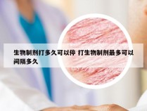 生物制剂打多久可以停 打生物制剂最多可以间隔多久