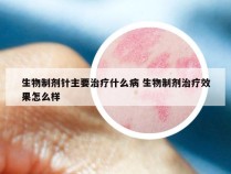 生物制剂针主要治疗什么病 生物制剂治疗效果怎么样