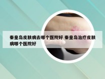 秦皇岛皮肤病去哪个医院好 秦皇岛治疗皮肤病哪个医院好