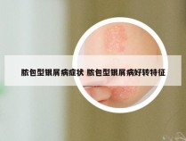 脓包型银屑病症状 脓包型银屑病好转特征