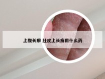 上腹长癣 肚皮上长癣用什么药