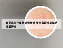 秦皇岛治疗皮肤病哪里好 秦皇岛治疗皮肤病哪里好点