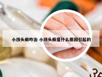 小孩头癣咋治 小孩头癣是什么原因引起的